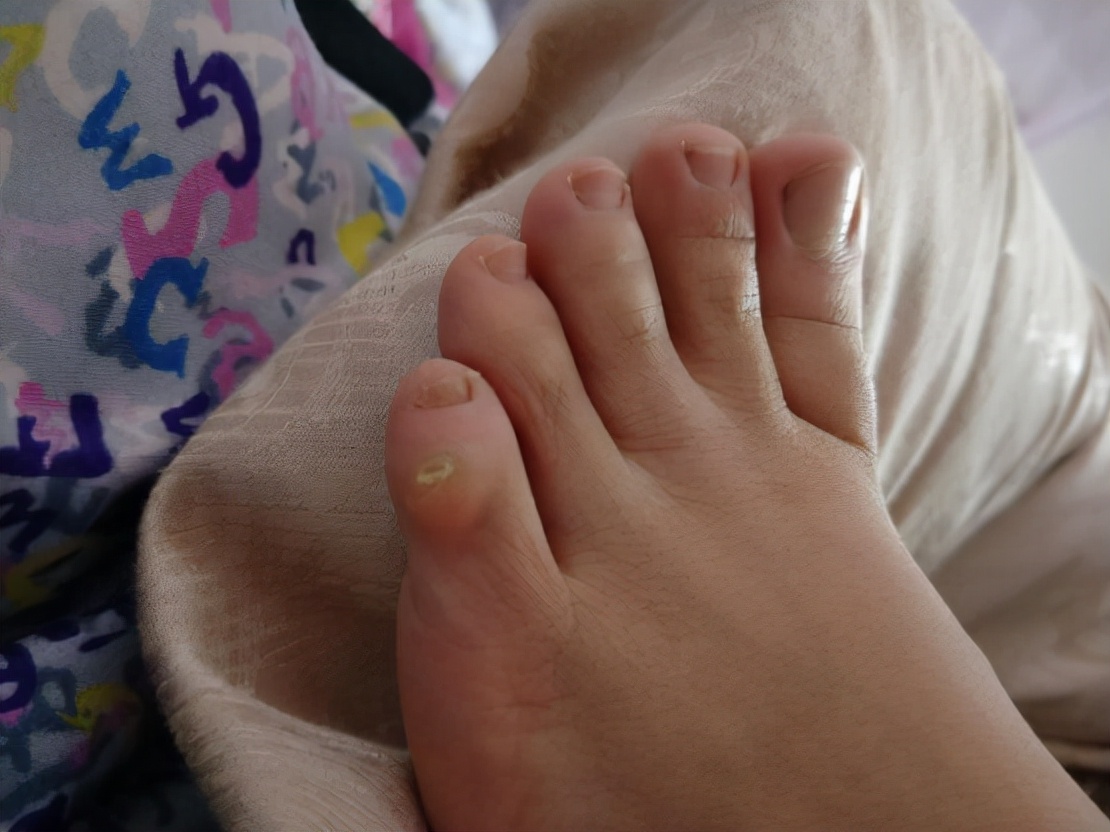 身体有癌脚先知道,脚出现这些症状可能是大病的前兆