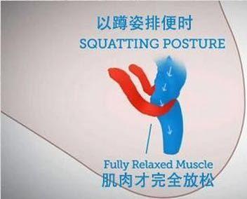 马桶与皮肤接触会传染疾病吗,蹲坑和马桶哪个容易返臭