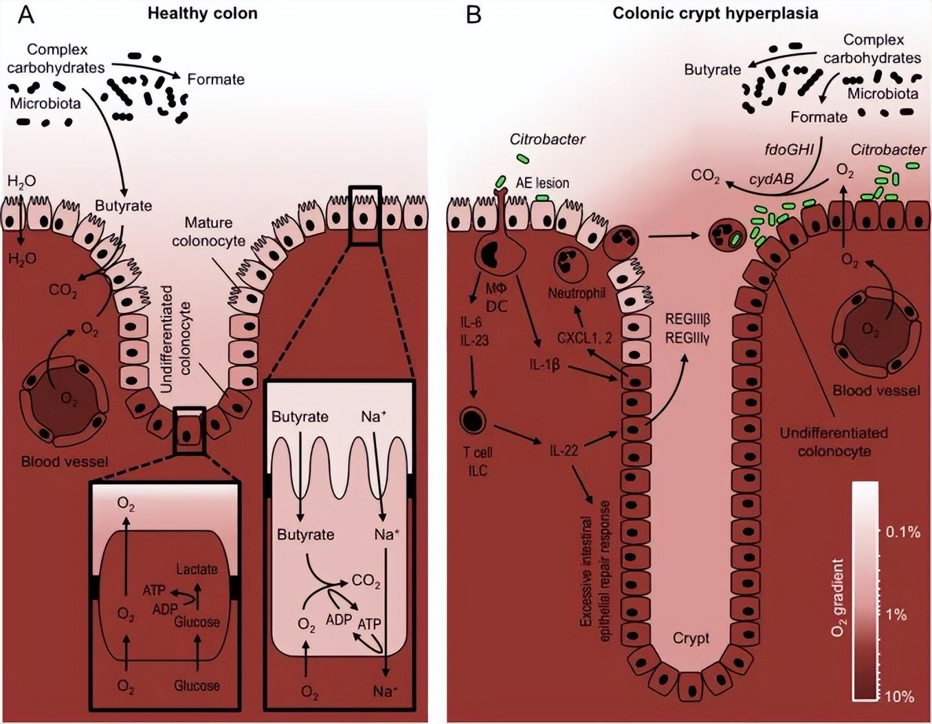 肠道侧漏会是什么症状,肠道渗漏什么意思
