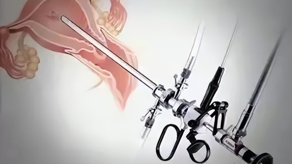 家长要小心儿童鼻腔异物,家长注意幼儿口袋里物品