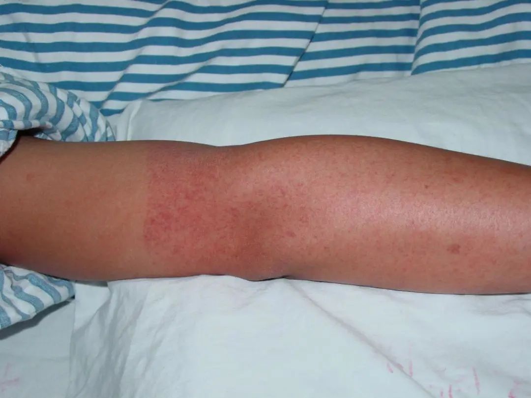 为什么广东春夏秋冬都有蚊子,广东蚊子最怕的地方