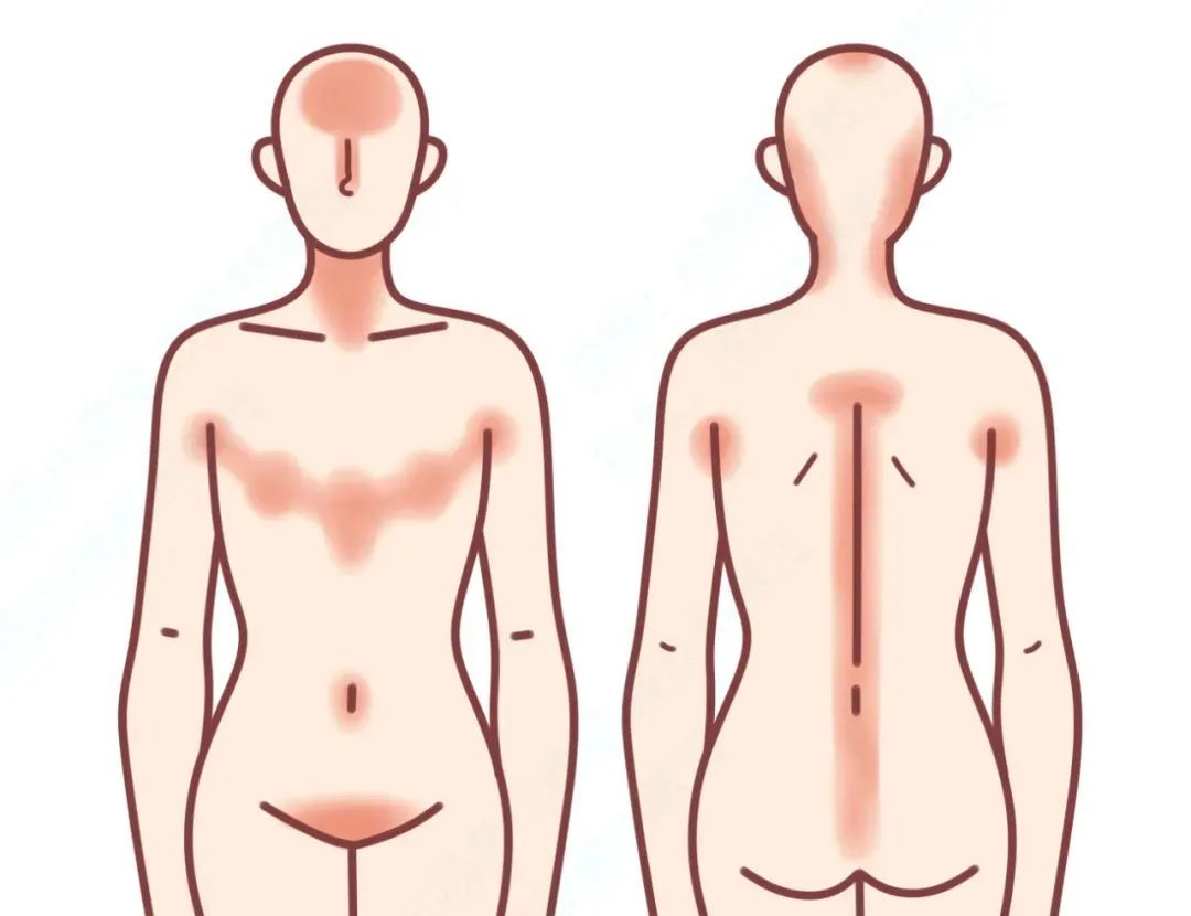 胸部的乳头有小疙瘩,男性乳头长疙瘩发痒