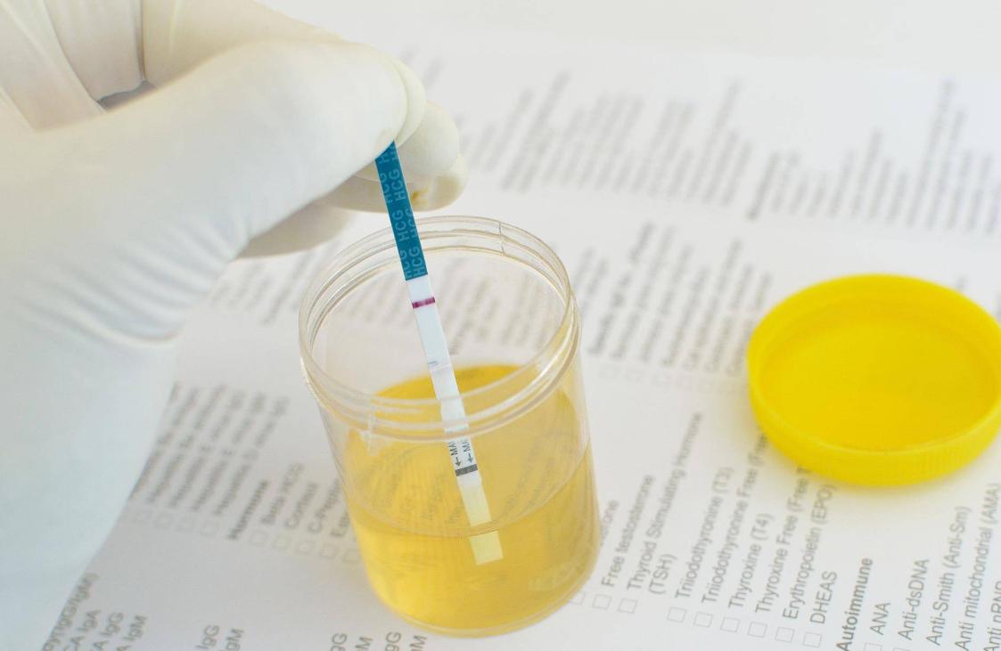 饮水多尿液无色透明正常吗,水喝多了尿像白开水一样正常吗