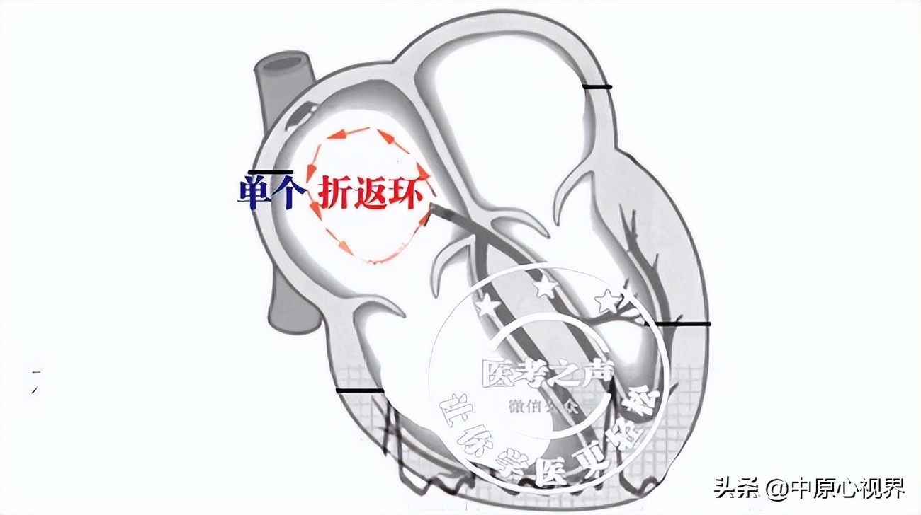 护考几种常见的心电图,常见的心电图图形分析