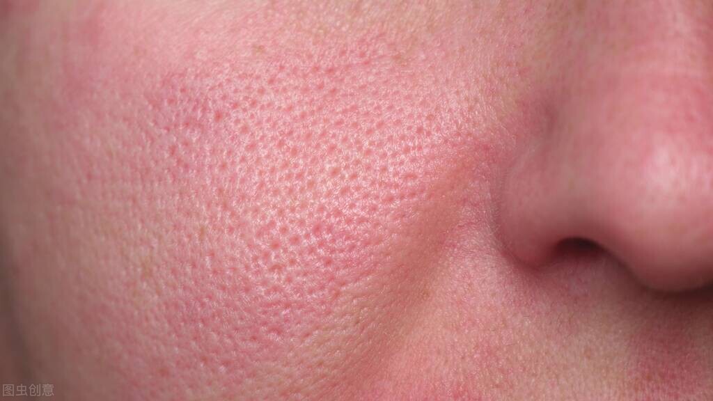 有效修复毛囊缩小毛孔,缩小毛孔最有效的医美