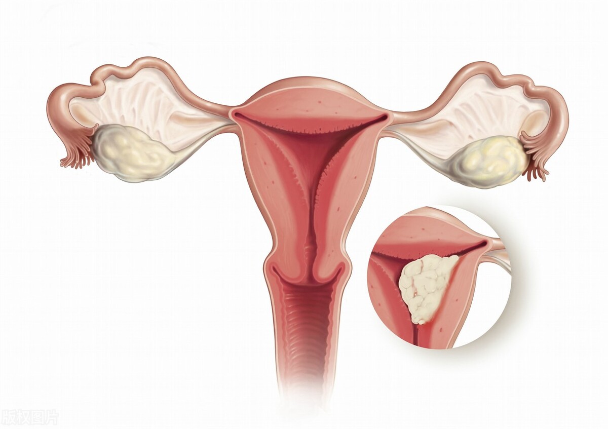 偶然一次出血要紧吗,偶尔一次出血是因为什么