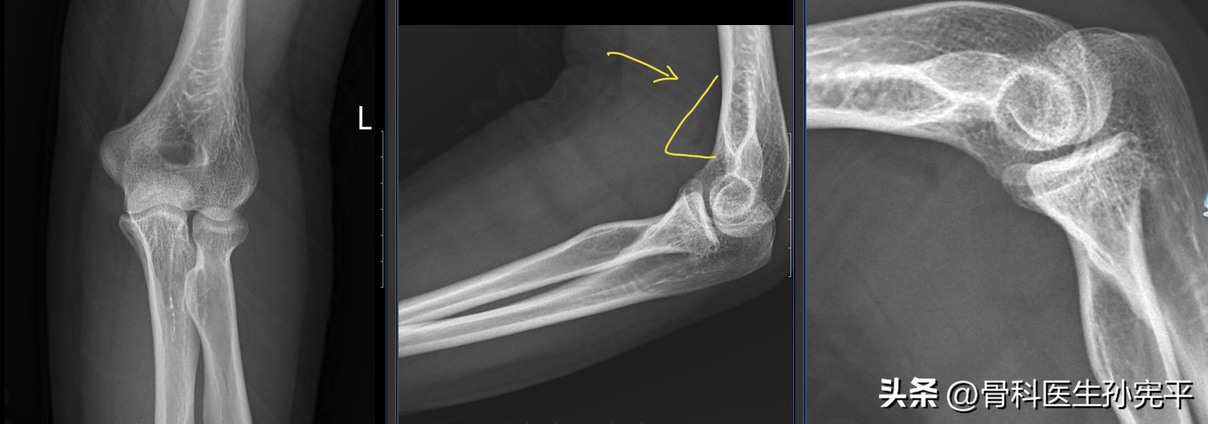 医学影像趣图,震撼的医学影像