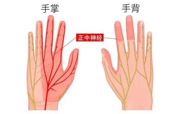 手麻腕管综合征,手指麻是腕管炎吗