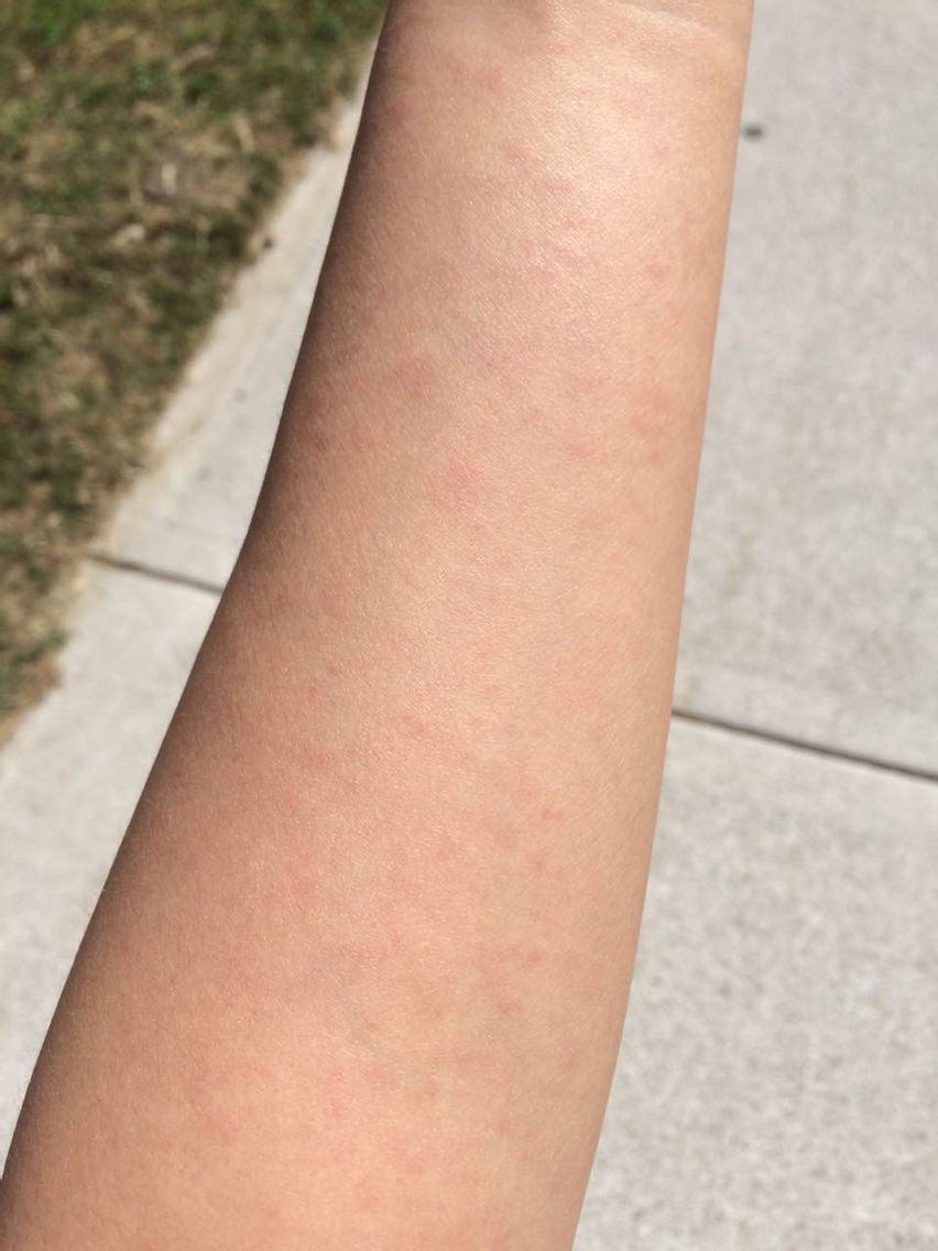 在“深入了解”前，如何判断对象有没有性病？医生：这几点要记住