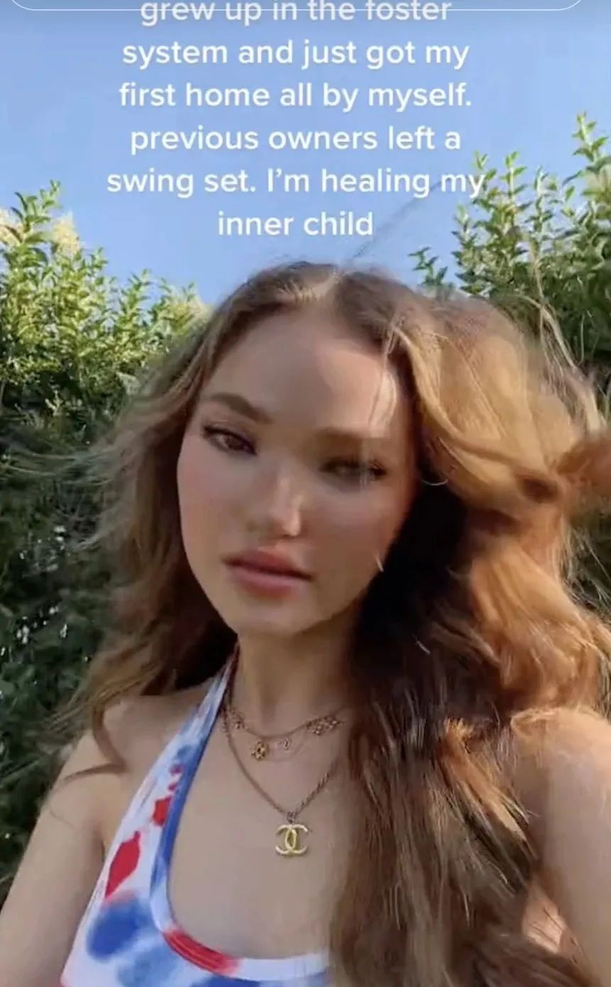 卡戴珊身体整形,卡戴珊做了哪些整容手术