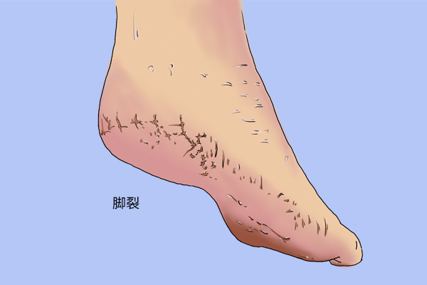 人老脚先衰是什么意思,人老脚先老如何防止脚部衰老