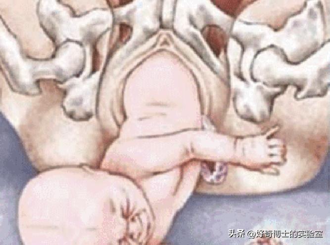 女生阴道还有长短？多长才算正常？太长太短对*生活性**有哪些影响？