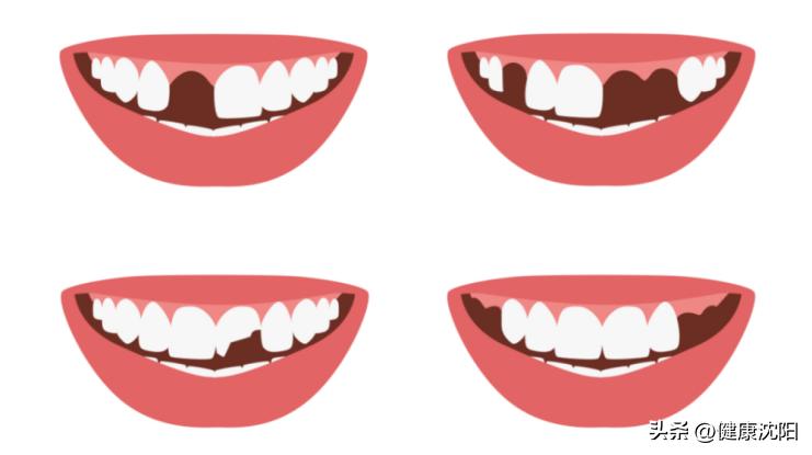 青少年如何保护牙齿,健康教育课保护牙齿