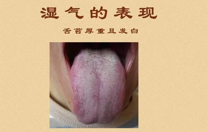 女性注意了这里越黑湿气越重