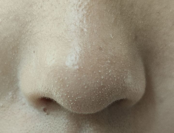 涂完粉底液鼻子上有白点,上完粉底液之后为什么鼻子有白点