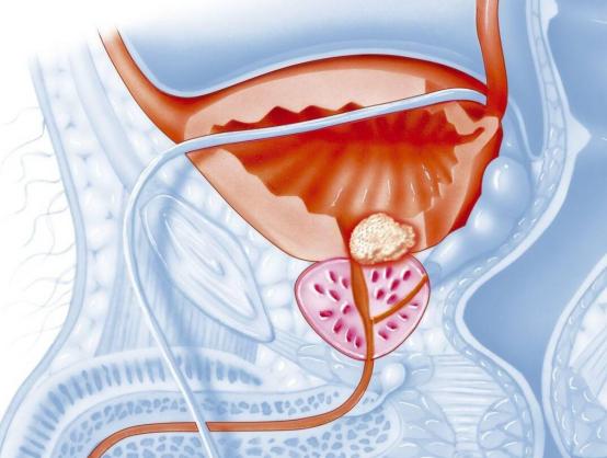 一位单身女青年的疑问：同房时，男人射精和尿尿会同时发生吗？