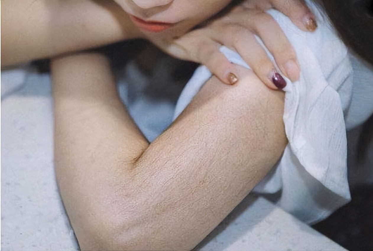 人的体毛旺盛是因为什么,为什么人的体毛多