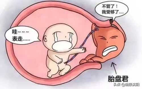 孕妇凶险性前置胎盘怎么办,前置胎盘是妊娠并发症吗