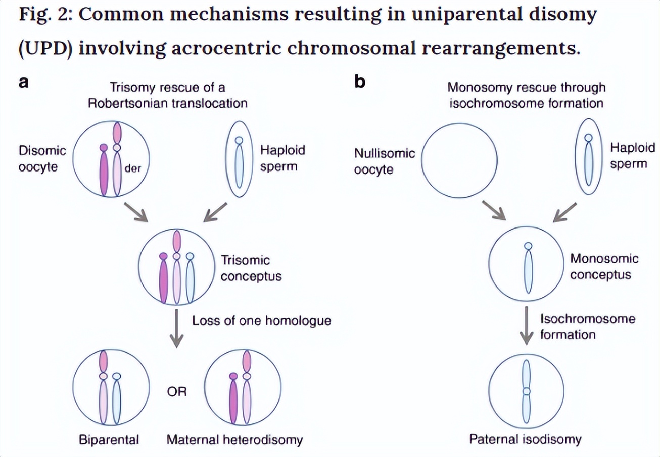 试管婴儿pgt-a检测结果怎么看,试管婴儿不孕不育基因检测