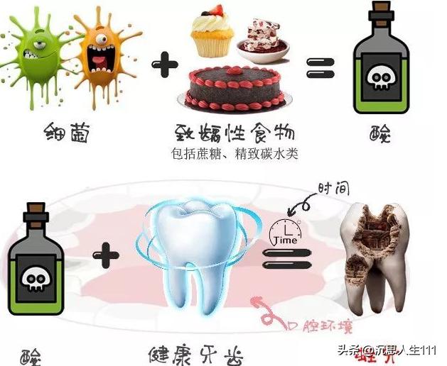 龋齿的形成原因和过程动画,龋齿发生机制的图片