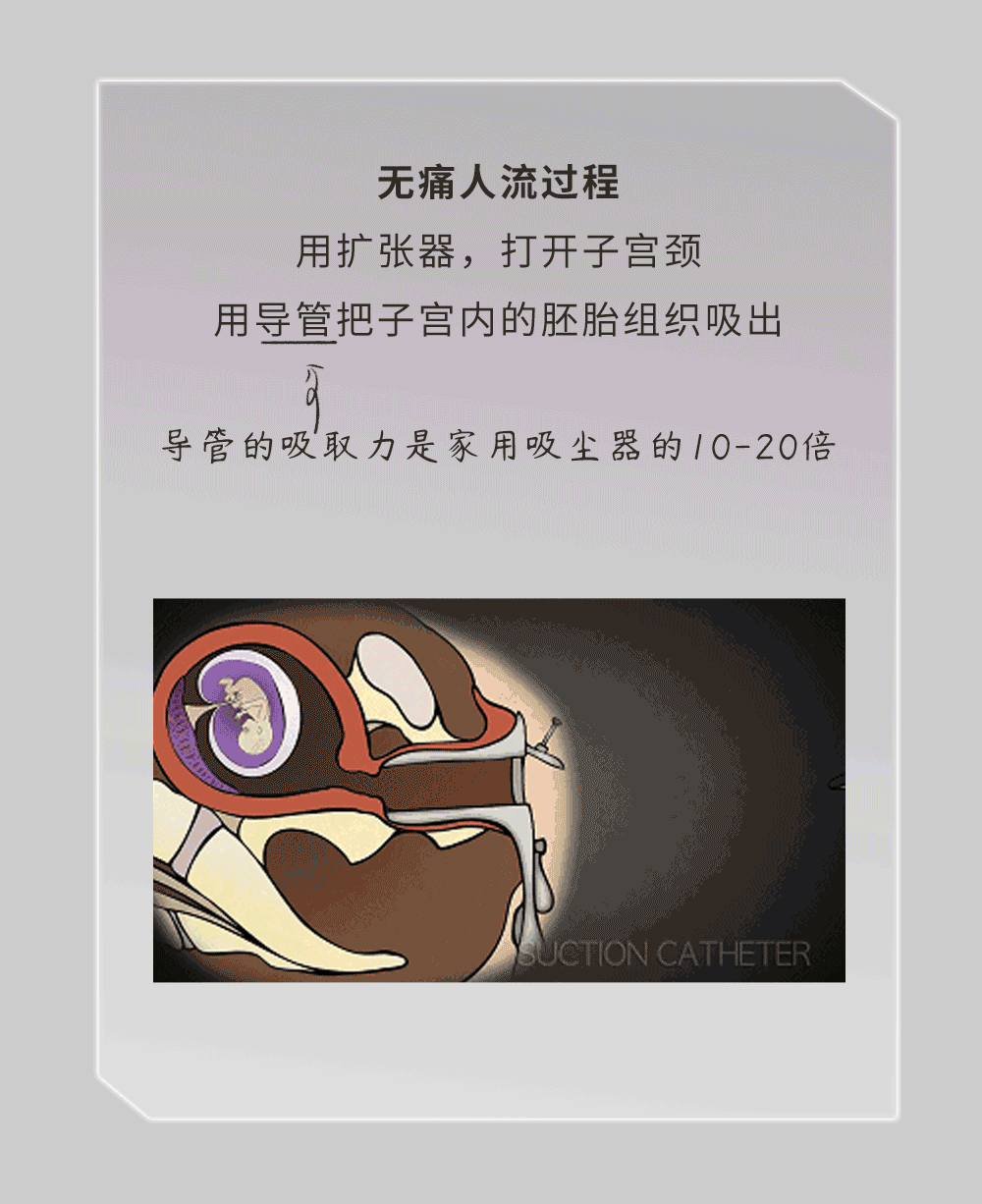 为什么女生在安全期也会怀孕,为什么女性会意外怀孕