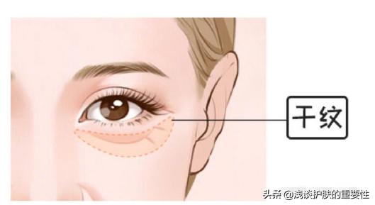 去掉眼纹会不会更显年轻,有眼纹和眼袋哪个更显老