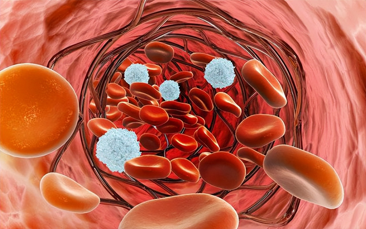 过敏性紫癜挂哪个科室,过敏性紫癜在血液病中严重吗