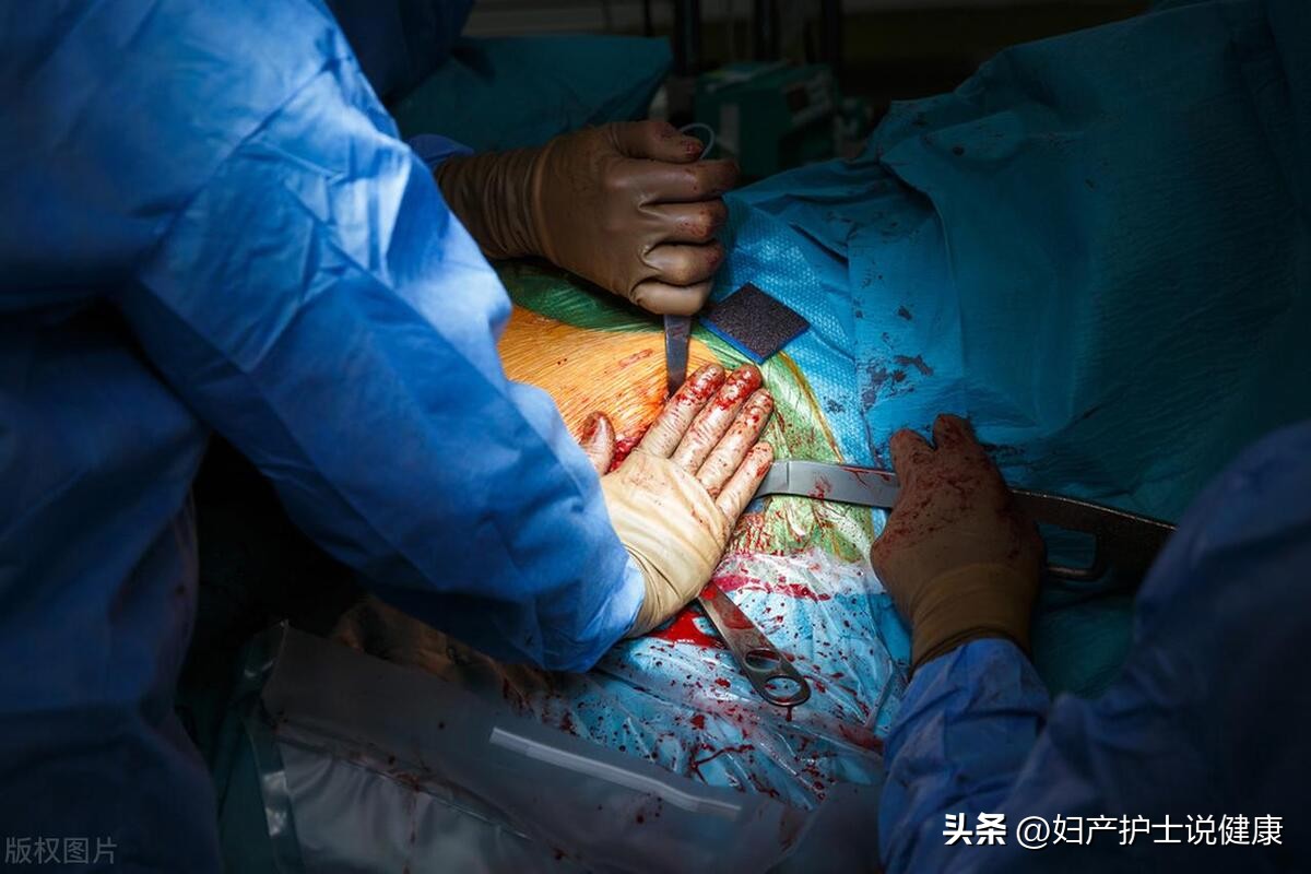 80多岁老太右下腹痛是什么毛病,60岁女人腹部疼痛胀气