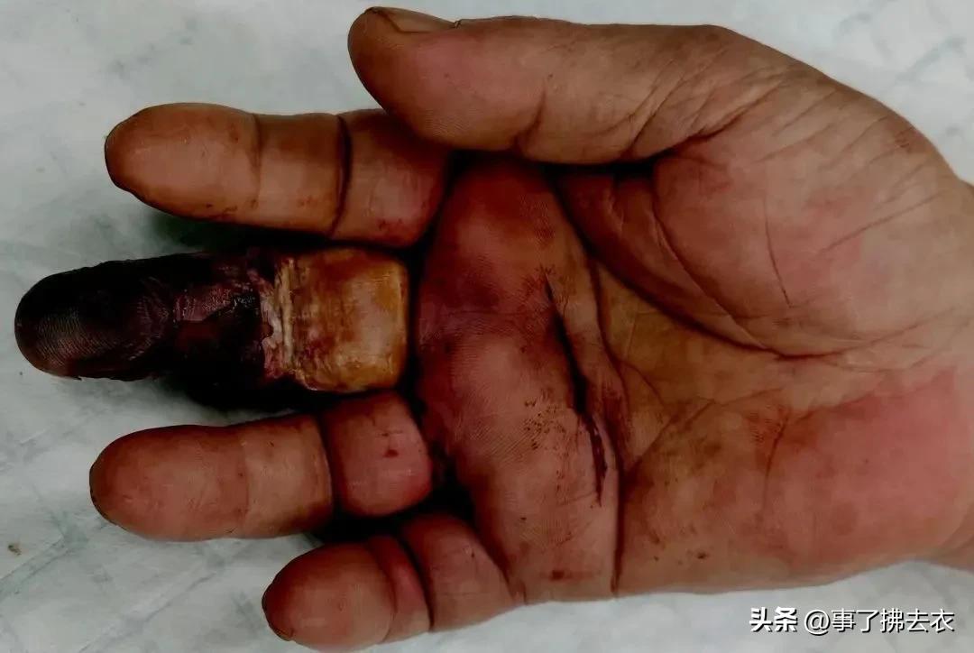 一条鱼引发的惨剧,一条鱼引发的悲剧8死13伤