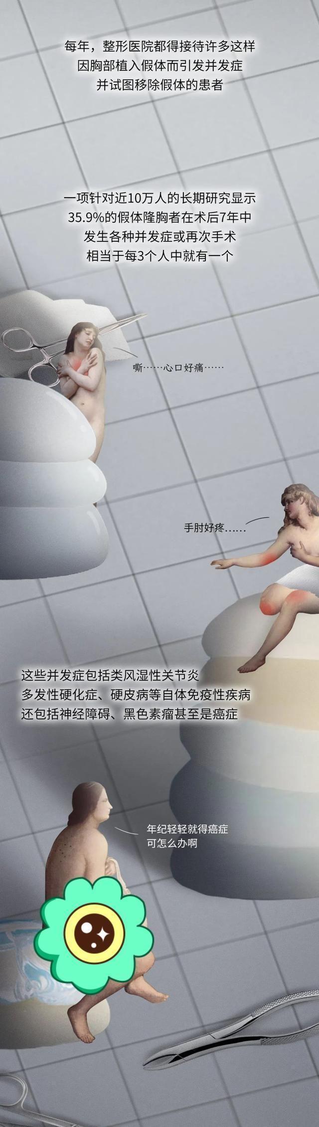 第一个隆胸的女人,第一个假体隆胸的人