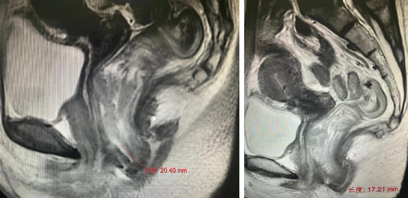 荆门二医介入科,荆门二医重点专科