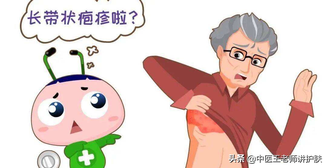 治带状疱疹后遗症的神方,痛是血不通麻是气不通