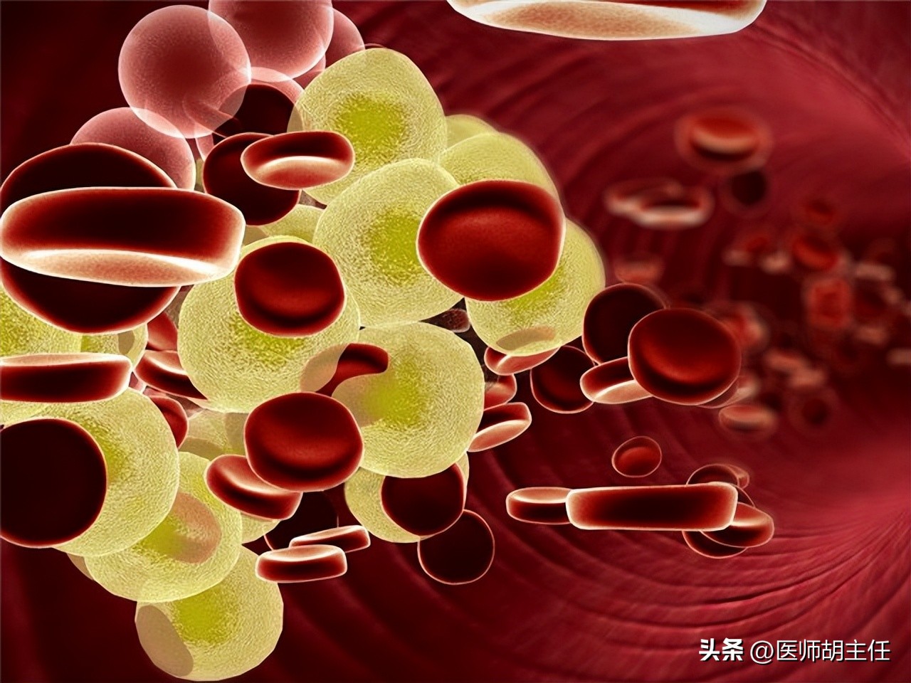 体检发现胆红素高是怎么回事,体检胆红素高怎么快速降下来