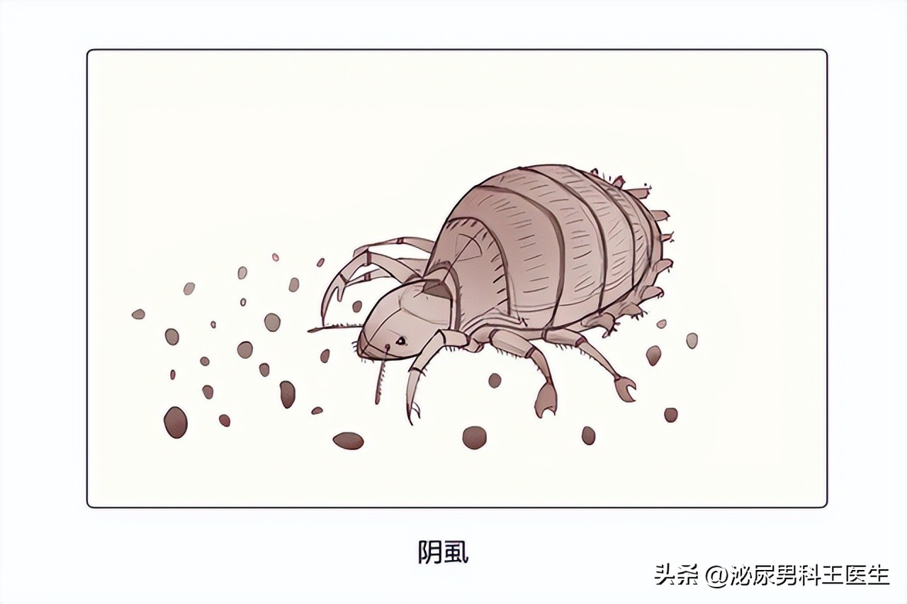 阴虱是什么？为什么现在很多人得阴虱？医生：离不开3个传播途径