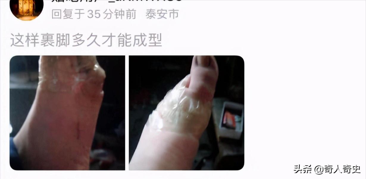 现代有人缠三寸金莲,现在还有人裹小脚吗