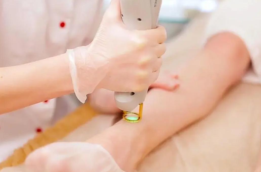 为什么有的女性*处私**没有毛？女性*处私**毛发的3个好处，别羞于了解