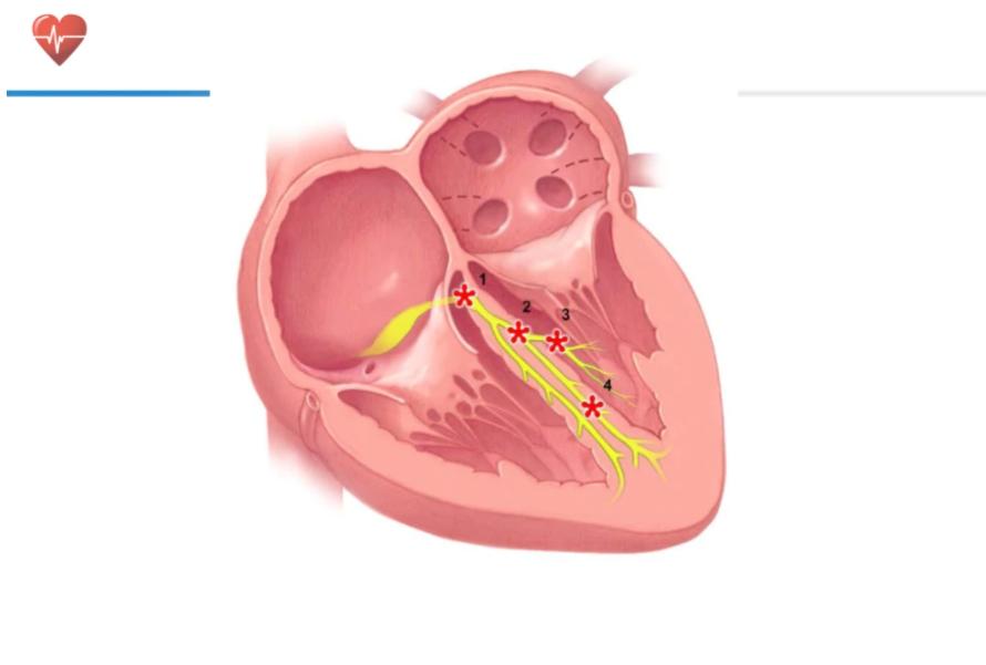 冠心病确诊必须造影吗,心脏造影和冠心病造影