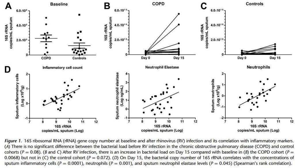 周敏教授：慢阻肺病、支扩及慢阻肺支扩重叠综合征气道微生物研究
