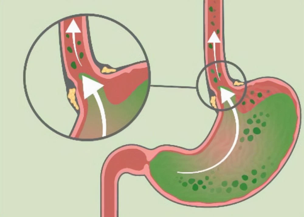 医生教你晚餐该怎么吃才健康,晚餐吃饱不胖的方法