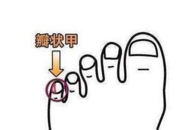 华夏子孙的3个印记:门牙、褶子和脚趾,与生俱来且无法抹去