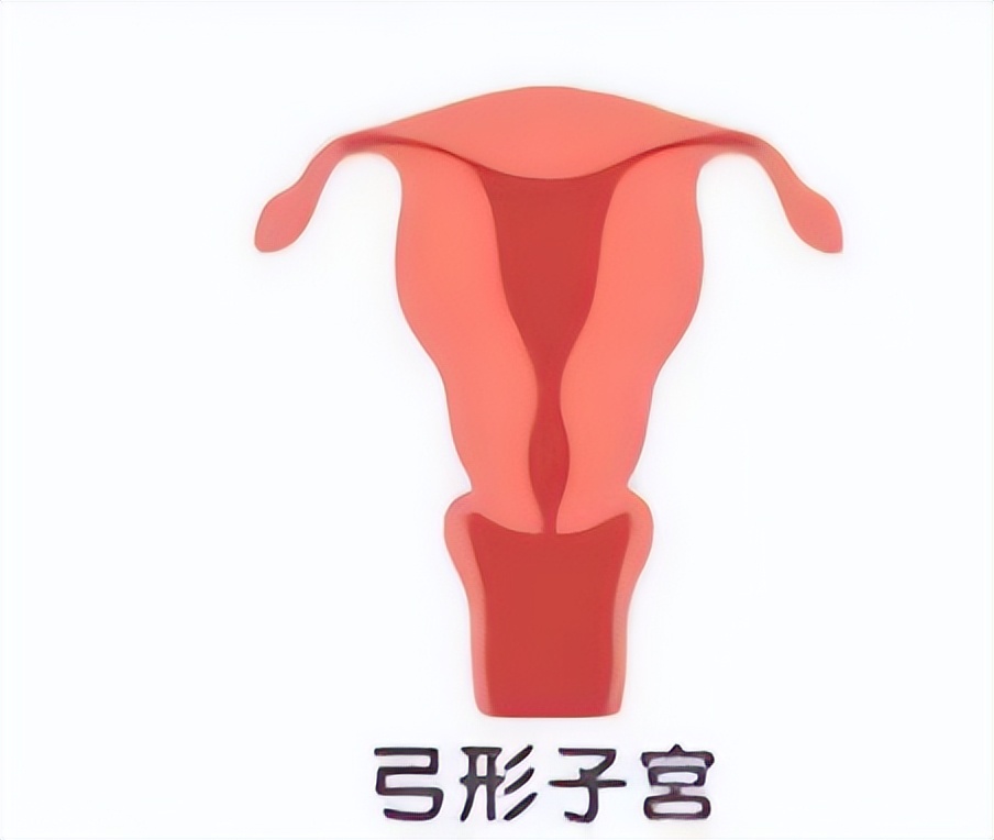七种子宫形状，你了解过吗？