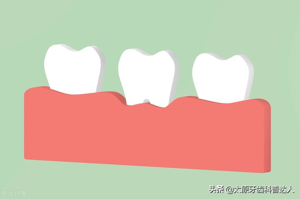 牙齿出现黑三角如何解决,牙齿出现黑三角有什么危害