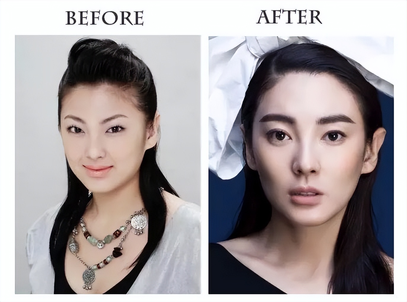 割双眼皮像变了个人,割了双眼皮像变了个人