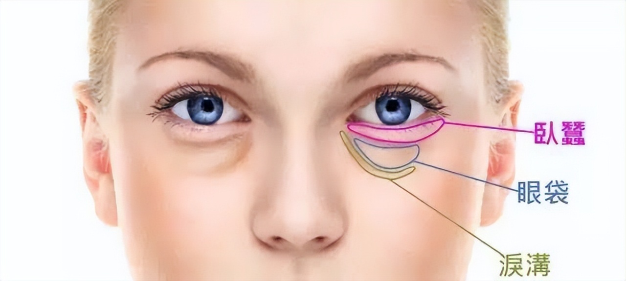 专治黑眼圈的方法,如何自测黑眼圈