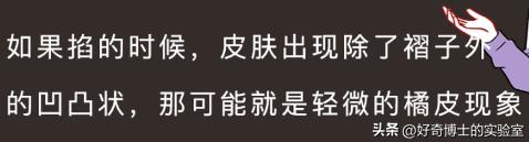 大腿上有白色条纹怎么回事,女生大腿外侧有红条纹是什么原因