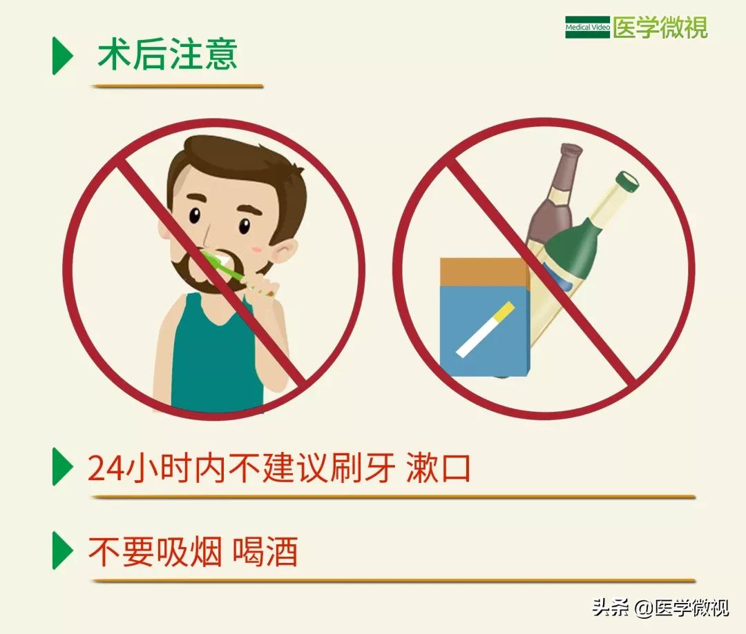 拔智齿是硬把牙拽下来吗,拔智齿到底要不要拔掉