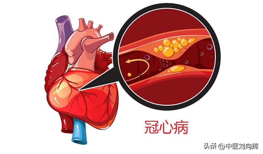 血府逐瘀大药丸哪家最好用,什么牌子的血府逐瘀丸效果好