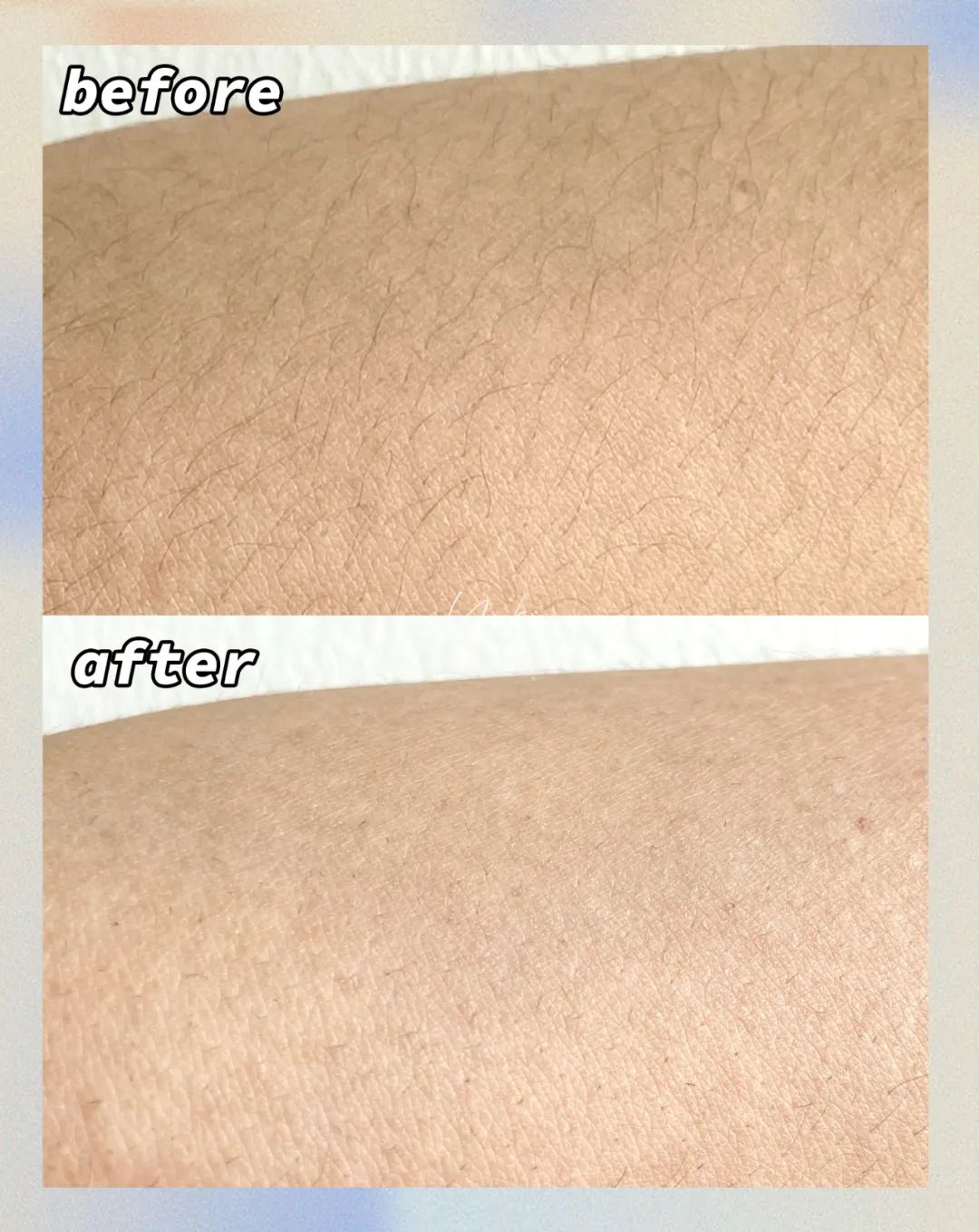 全网最好用的脱毛产品,热门口碑脱毛产品