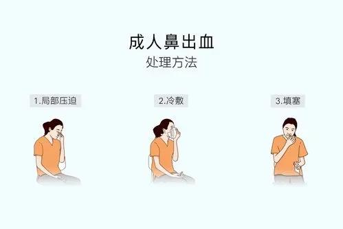 鼻出血射频止血大概需要多久恢复,小孩鼻出血快速止血方法