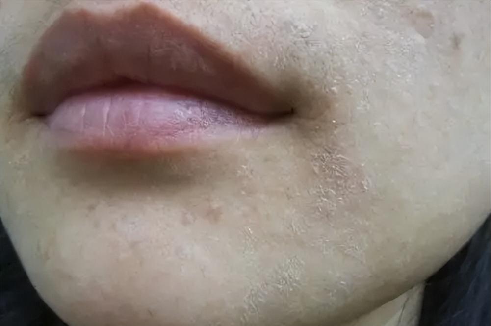 脸泛红是洗面奶的原因吗,为什么用完洗面奶脸会变白